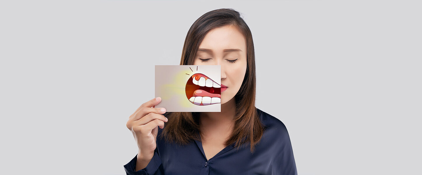 Gum Contouring in Houston TX
