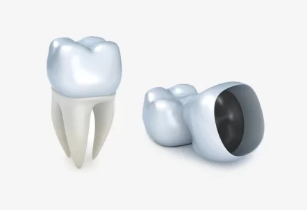How Dentists Ensure a Perfect Fit for Your Dental Crown