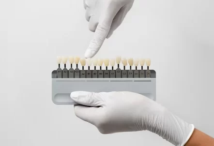 The Ultimate Guide to Caring for Your Porcelain Veneers: What Every Patient Should Know