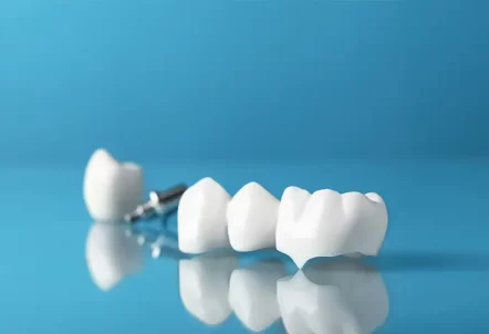 Porcelain Crowns in Houston, TX: A Patient’s Guide